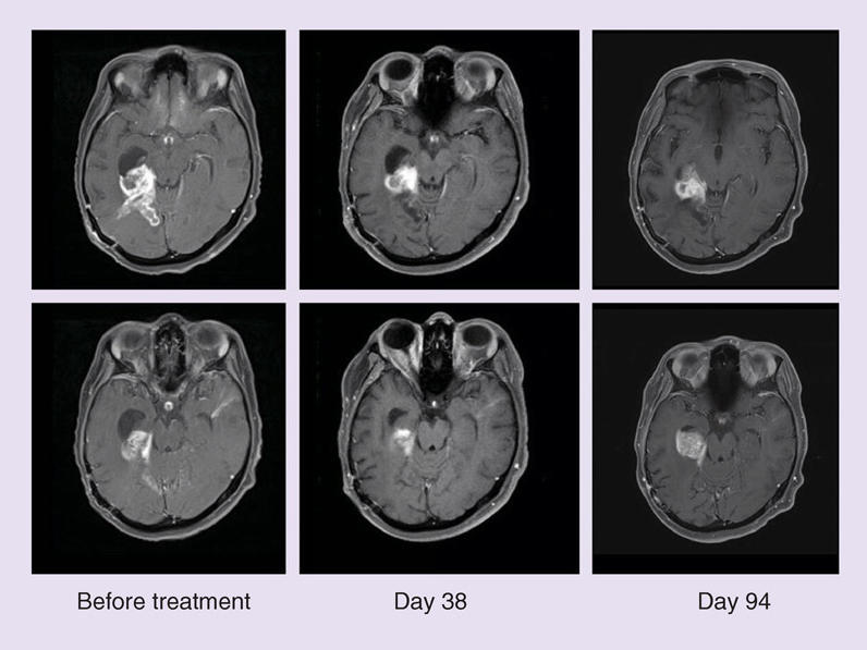 Magnetic-Resonance-Imaging.jpg