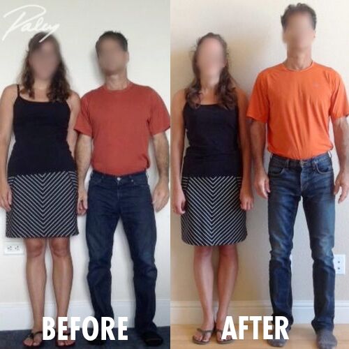 肢体延长术价格对比：“断骨增高”美德韩三强谁更值得选择？