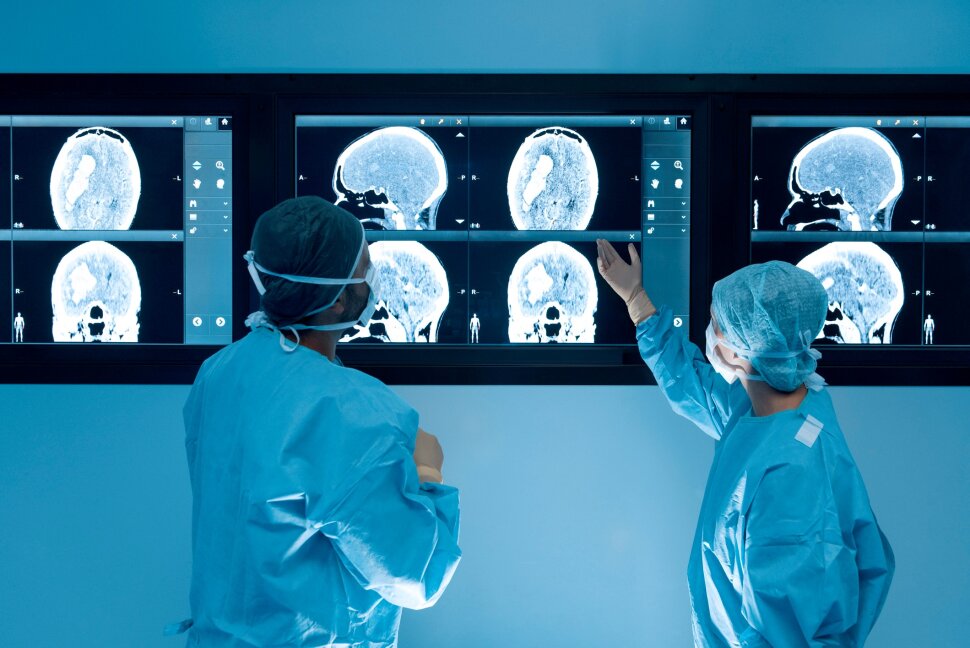2025胰腺癌新药疗效惊人：客观缓解率达50%、生存期延长至16.2个月！患者生存希望大增！