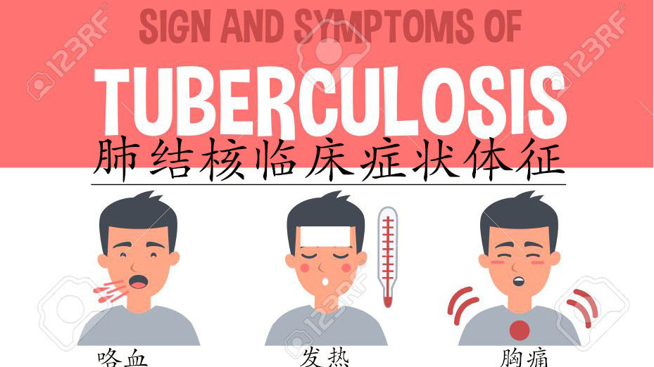 出国看病  肺结核的临床表现