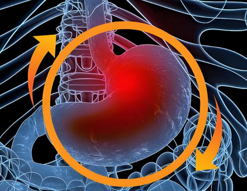 真实案例 | 胃食管反流反复发作？远程连线美国顶级专家，获取治愈方案！