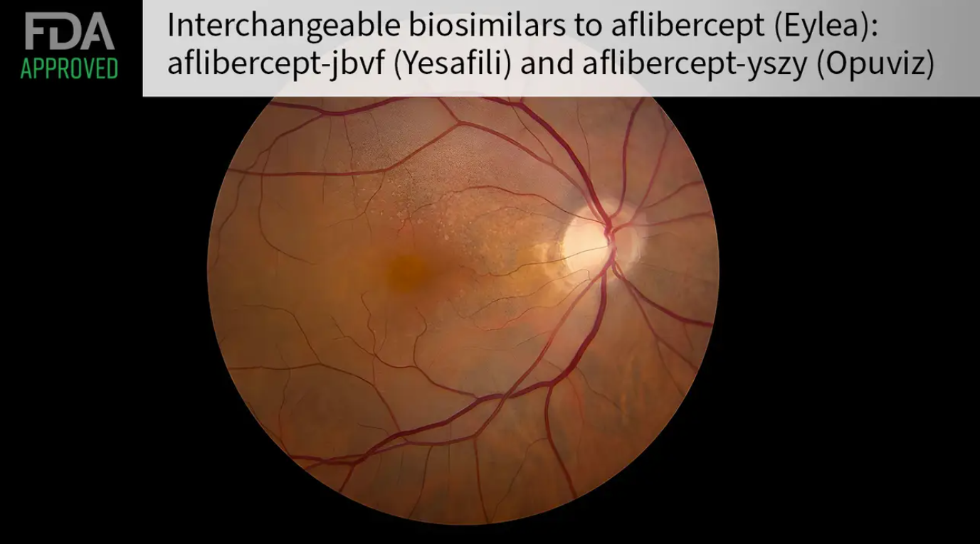 2024美国治疗黄斑眼底病变新药Opuviz和Yesafili获FDA批准上市
